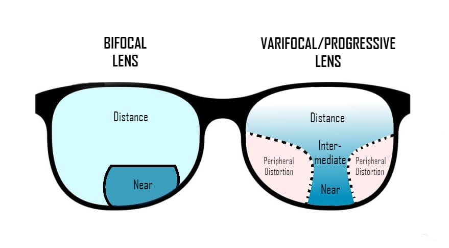 Progressive Lenses vs Bifocals: Which is Right for You?