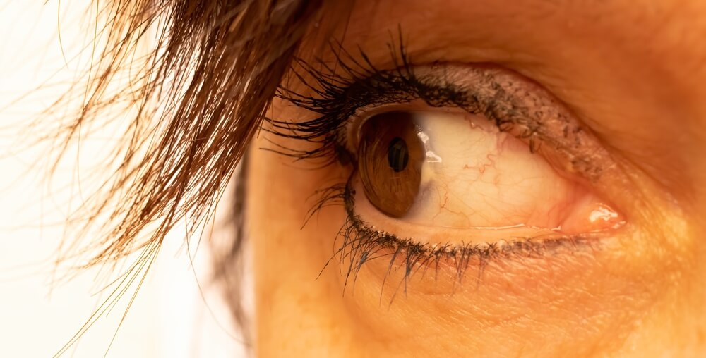 Top Causes, Home Treatments, and Surgery Costs for Pinguecula Eye